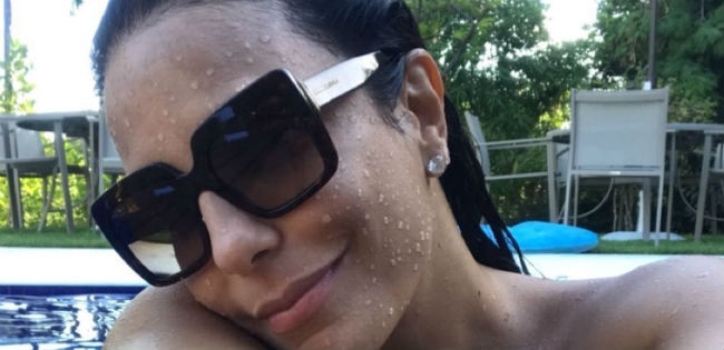 URGENTE Ivete Sangalo revela que está melasma DEOLHO NEWS