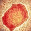Onze países já têm casos de varíola do macaco; veja a lista