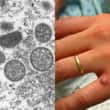 Mais 4 casos de varíola do macaco são identificados na Europa