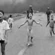 ‘Garota Napalm’, da famosa foto na Guerra do Vietnã passa por último tratamento de pele 