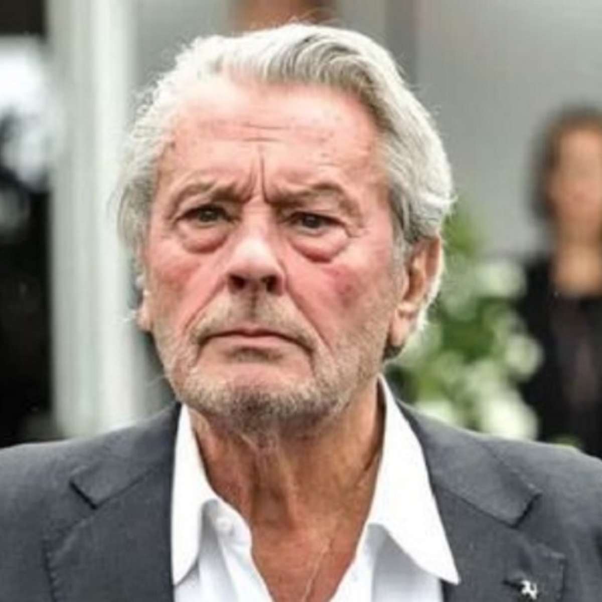 Ator Alain Delon pede eutanásia