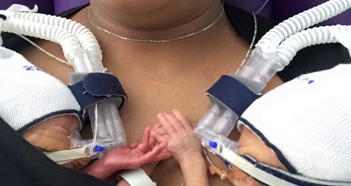 gêmeos prematuros ficam de mãos dadas e vídeo viraliza na internet