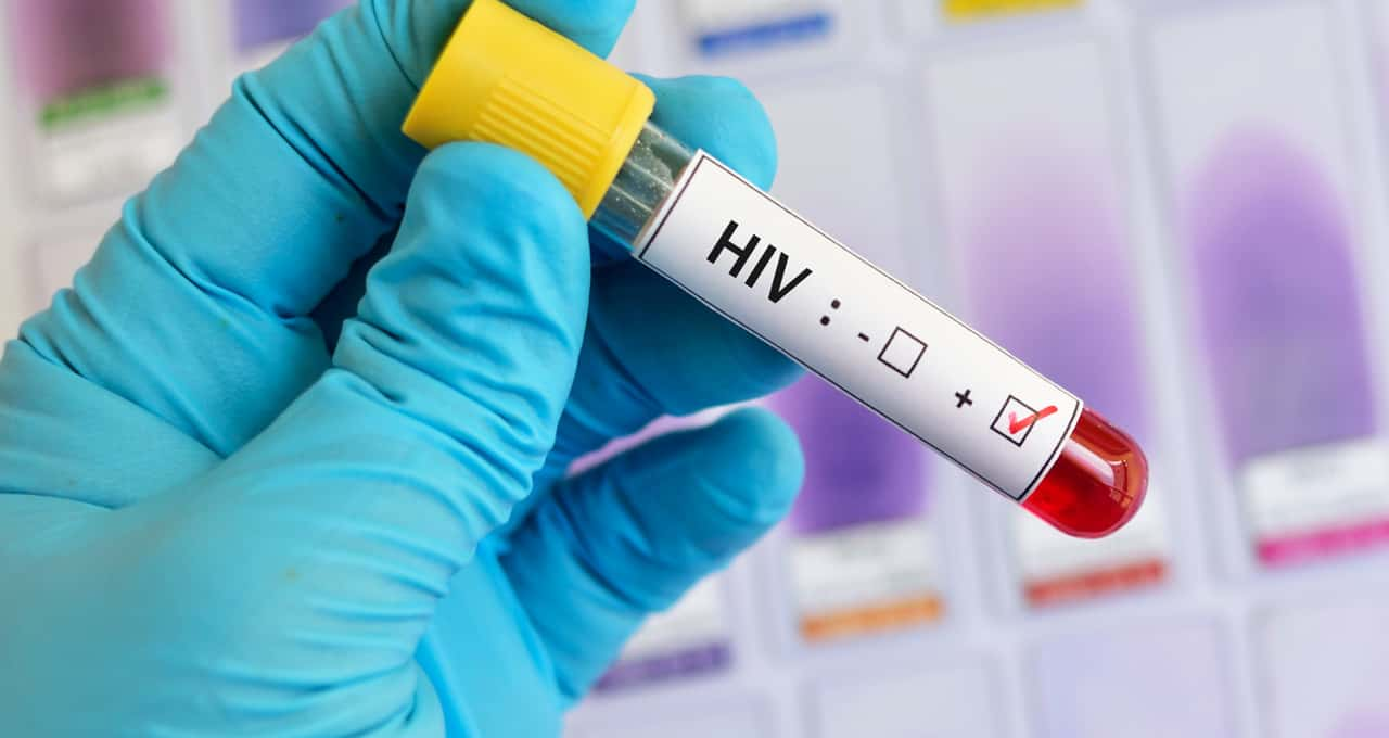 Sintomas de HIV: sinais iniciais que você precisa saber