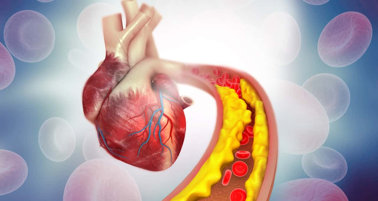 Como reduzir o colesterol ruim e prevenir doenças crônicas