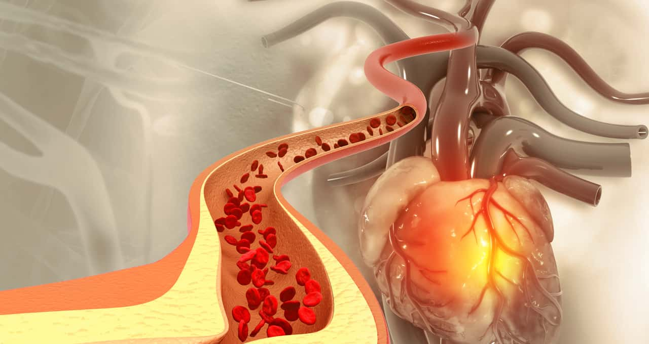 Saiba como reduzir o colesterol ruim para evitar doenças crônicas