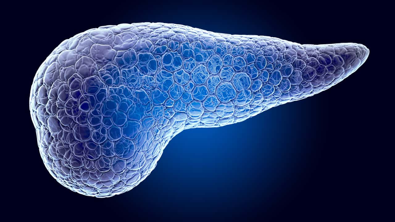 Detecting an early sign of pancreatic cancer in 75% of cases