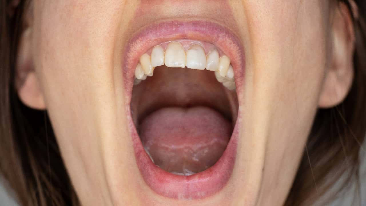 8 Anzeichen von Diabetes, die im Mund auftreten können:  Erfahren Sie, wie Sie es erkennen