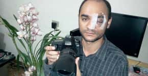 Justiça nega novamente indenização a fotógrafo que perdeu o olho