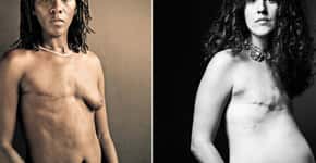 Câncer de mama: mulheres mostram o corpo em ensaio fotográfico