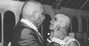 Noiva raspa cabeça no casamento para homenagear noivo com câncer terminal