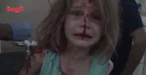 Menina se desespera ao procurar pelo pai após bombardeio na Síria