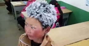 Imagem de chinês de 8 anos com cabelos congelados comove a web