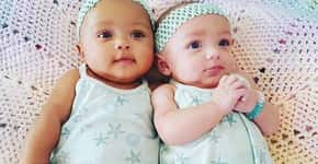 1 em cada 500: caso raro de gêmeas birraciais encanta a internet