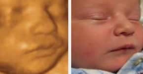 Fotos de bebês antes e depois do nascimento são a coisa mais fofa