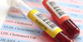 Exames de colesterol total são oferecidos gratuitamente em SP