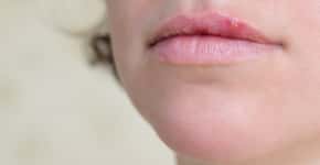 Quais sintomas de infecção sexualmente transmissível aparecem no rosto?