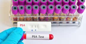 Saiba como fazer exames grátis de PSA para câncer de próstata