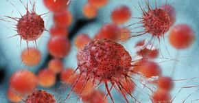 Cientistas usam vírus da herpes para tratar câncer de pele
