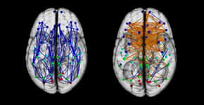Cérebros de homens e mulheres têm ‘conexões diferentes’