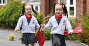 Gêmeas com Down comemoram primeiro dia em escola regular