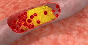Colesterol, o inimigo que também atinge as crianças