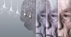 Riscos cardiovasculares podem indicar o mal de Alzheimer