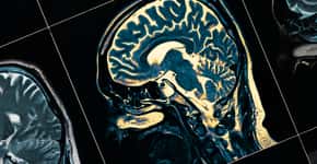 Cientistas descobrem estágios iniciais do mal de Parkinson