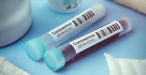 Fundação Oswaldo Cruz produz 30 mil testes para novo coronavírus