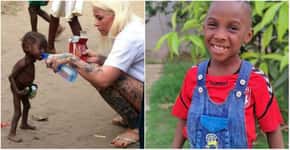 Menino resgatado desnutrido em 2016 na Nigéria está feliz e saudável