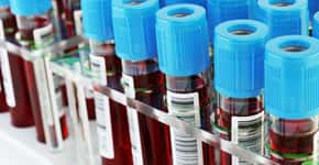 Estudo relata ligações entre tipos sanguíneos e risco de doenças