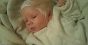 Bebê faz sucesso ao nascer com o cabelo todo branco no RS