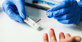 FDA pede que as pessoas não confiem nos testes de anticorpos