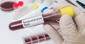 Baixa testosterona aumenta risco de covid-19, descobre estudo