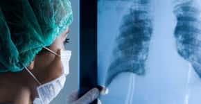 São Paulo faz primeiro transplante de pulmão bem sucedido pós-covid