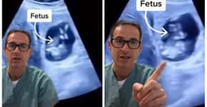 Gravidez ectópica: exame mostra feto crescendo no fígado da mãe