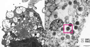 Cientistas revelam primeira imagem microscópica da variante Ômicron