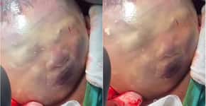 Vídeo mostra rosto de bebê se mexendo dentro do saco amniótico