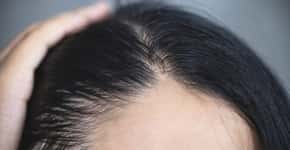 Estudo descobre que remédio para artrite faz cabelo crescer