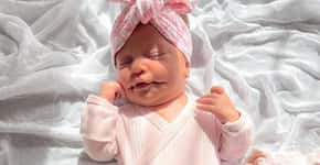 Bebê nasce com condição que a faz parecer que está sempre sorrindo