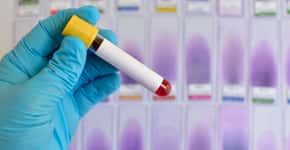 Comunidade de Heliópolis poderá fazer teste gratuito de Hepatite C