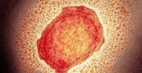 Onze países já têm casos de varíola do macaco; veja a lista