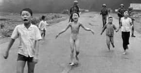 ‘Garota Napalm’, da famosa foto na Guerra do Vietnã passa por último tratamento de pele 