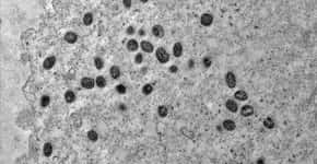 Fiocruz registra imagem da replicação do vírus monkeypox em célula