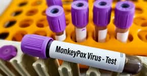 Monkeypox: transmissão também pode ocorrer na ausência de sintomas