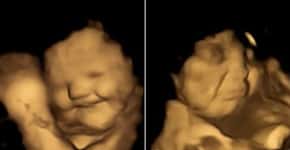 Ultrassom mostra fetos reagindo ao sabor dos alimentos ingeridos pela mãe