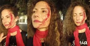 Jornalista da CNN com adesivo do Lula é agredida em Curitiba