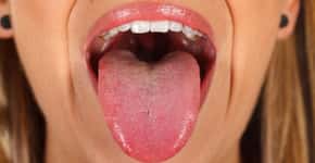 Sinal na língua que não desaparece pode indicar câncer