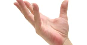Sinais nas mãos indicam doença hepática gordurosa