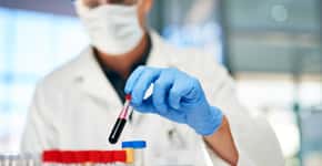 Estudo defende exame de sangue para prever quem terá Alzheimer