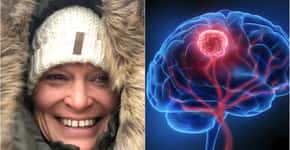 Mulher descobre tumor cerebral após apresentar estes 3 sintomas
